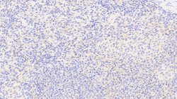 Invitrogen G6PD Polyclonal Antibody:Antibodies:Primary Antibodies