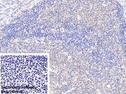 Invitrogen G6PD Polyclonal Antibody:Antibodies:Primary Antibodies