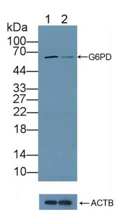 Invitrogen G6PD Polyclonal Antibody:Antibodies:Primary Antibodies