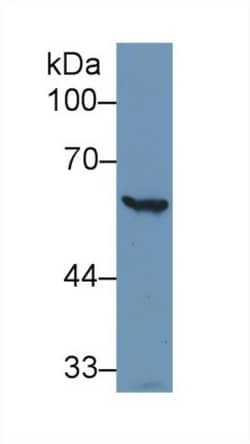Invitrogen G6PD Polyclonal Antibody:Antibodies:Primary Antibodies