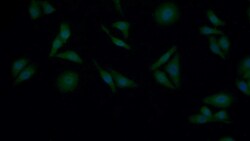 Invitrogen GUSB Polyclonal Antibody 200 &mu;L | Buy Online | Invitrogen&trade; | Fisher Scientific