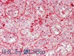 Invitrogen GUSB Polyclonal Antibody 20 &mu;L; Unconjugated:Antibodies,