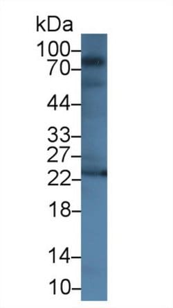 Invitrogen GUSB Polyclonal Antibody 20 &mu;L; Unconjugated:Antibodies,