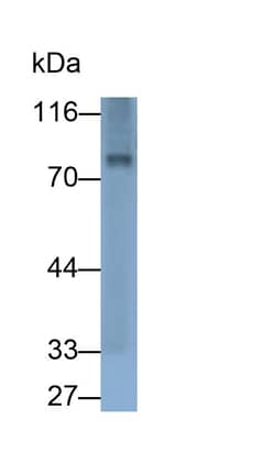 Invitrogen GUSB Polyclonal Antibody 200 &mu;L | Buy Online | Invitrogen&trade; | Fisher Scientific