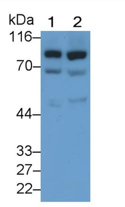 Invitrogen GUSB Polyclonal Antibody 200 &mu;L | Buy Online | Invitrogen&trade; | Fisher Scientific