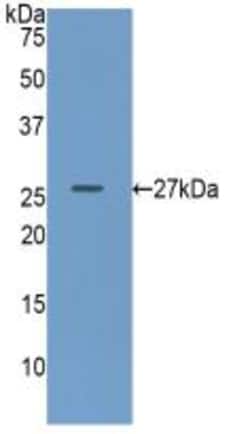 Invitrogen GUSB Polyclonal Antibody 200 &mu;L | Buy Online | Invitrogen&trade; | Fisher Scientific