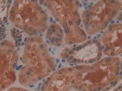 Invitrogen GPX4 Polyclonal Antibody 200 &mu;L; Unconjugated:Antibodies,
