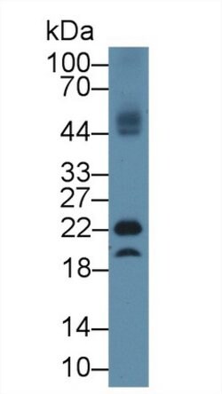 Invitrogen GPX4 Polyclonal Antibody 200 &mu;L; Unconjugated:Antibodies,