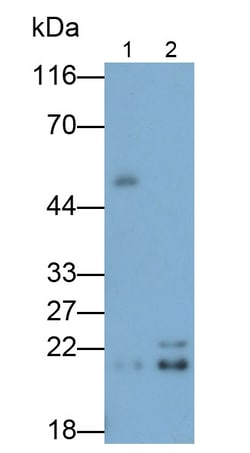 Invitrogen GPX4 Polyclonal Antibody:Antibodies:Primary Antibodies