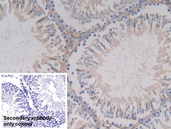 Invitrogen GSTA4 Polyclonal Antibody:Antibodies:Primary Antibodies