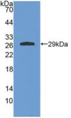 Invitrogen GSTA4 Polyclonal Antibody:Antibodies:Primary Antibodies