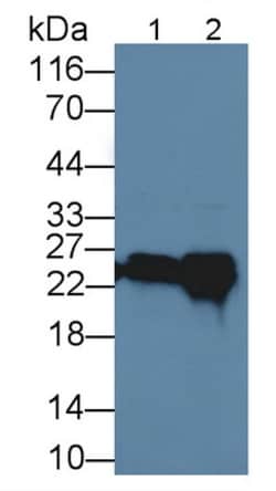 Invitrogen GSTA4 Polyclonal Antibody:Antibodies:Primary Antibodies