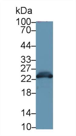 Invitrogen GSTA3 Polyclonal Antibody 20 &mu;L; Unconjugated:Antibodies,