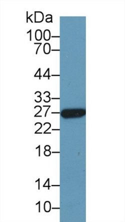 Invitrogen GSTA5 Polyclonal Antibody:Antibodies:Primary Antibodies