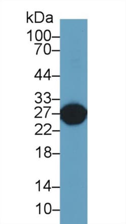 Invitrogen GSTA5 Polyclonal Antibody:Antibodies:Primary Antibodies