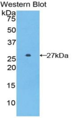 Invitrogen GSTA5 Polyclonal Antibody:Antibodies:Primary Antibodies