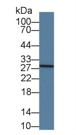 Invitrogen GSTM4 Polyclonal Antibody:Antibodies:Primary Antibodies