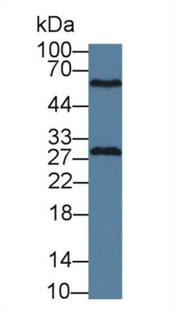 Invitrogen GSTM4 Polyclonal Antibody:Antibodies:Primary Antibodies