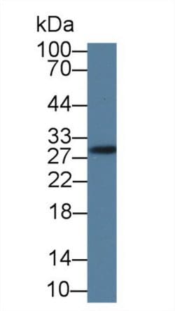 Invitrogen GSTM4 Polyclonal Antibody:Antibodies:Primary Antibodies