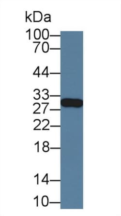 Invitrogen GSTM4 Polyclonal Antibody:Antibodies:Primary Antibodies