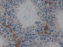 Invitrogen GSTT2 Polyclonal Antibody:Antibodies:Primary Antibodies