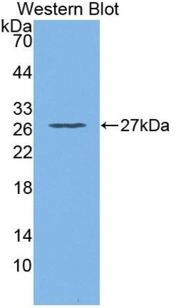 Invitrogen GSTT2 Polyclonal Antibody:Antibodies:Primary Antibodies