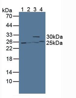 Invitrogen GSTT2 Polyclonal Antibody 200 &mu;L; Unconjugated:Antibodies,