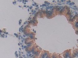 Invitrogen GSTT2 Polyclonal Antibody 20 &mu;L; Unconjugated:Antibodies,