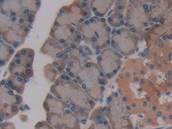 Invitrogen GSTT2 Polyclonal Antibody 20 &mu;L; Unconjugated:Antibodies,