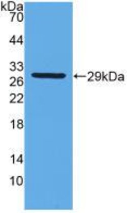 Invitrogen GSTT2 Polyclonal Antibody 20 &mu;L; Unconjugated:Antibodies,