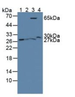 Invitrogen GSTT2 Polyclonal Antibody 20 &mu;L; Unconjugated:Antibodies,