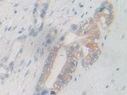 Invitrogen PYGB Polyclonal Antibody:Antibodies:Primary Antibodies