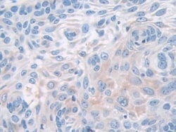 Invitrogen PYGB Polyclonal Antibody:Antibodies:Primary Antibodies