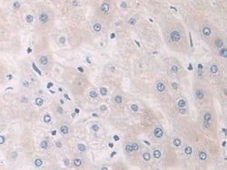 Invitrogen PYGB Polyclonal Antibody:Antibodies:Primary Antibodies