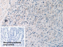 Invitrogen PYGB Polyclonal Antibody:Antibodies:Primary Antibodies