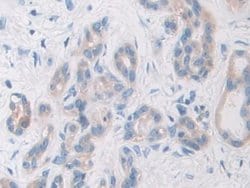 Invitrogen PYGB Polyclonal Antibody:Antibodies:Primary Antibodies