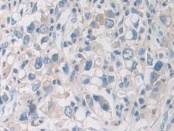 Invitrogen PYGB Polyclonal Antibody:Antibodies:Primary Antibodies