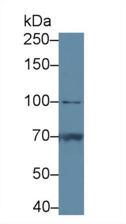 Invitrogen PYGB Polyclonal Antibody:Antibodies:Primary Antibodies