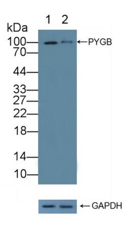 Invitrogen PYGB Polyclonal Antibody:Antibodies:Primary Antibodies