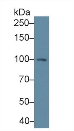 Invitrogen PYGB Polyclonal Antibody:Antibodies:Primary Antibodies