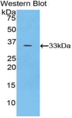Invitrogen PYGB Polyclonal Antibody:Antibodies:Primary Antibodies