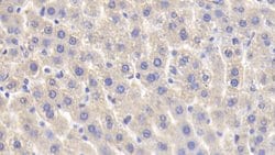 PYGL Polyclonal Antibody, Invitrogen 200 &mu;L; Unconjugated:Antibodies,