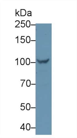 Invitrogen PYGL Polyclonal Antibody 20 &mu;L; Unconjugated:Antibodies,