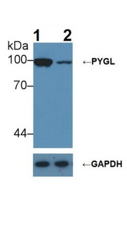 PYGL Polyclonal Antibody, Invitrogen 200 &mu;L; Unconjugated:Antibodies,