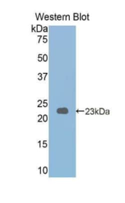 Invitrogen PYGL Polyclonal Antibody 20 &mu;L; Unconjugated:Antibodies,