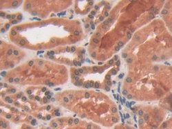 Invitrogen PYGL Polyclonal Antibody 20 &mu;L; Unconjugated:Antibodies,