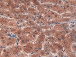 Invitrogen PYGL Polyclonal Antibody 20 &mu;L; Unconjugated:Antibodies,