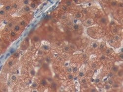 Invitrogen PYGL Polyclonal Antibody 20 &mu;L; Unconjugated:Antibodies,