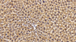 Invitrogen PYGL Polyclonal Antibody 20 &mu;L; Unconjugated:Antibodies,