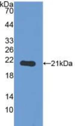 Invitrogen PYGL Polyclonal Antibody 20 &mu;L; Unconjugated:Antibodies,